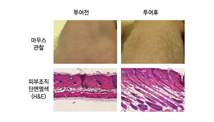 모낭조직 분화를 촉진하는 제대혈 줄기세포 분비 단백질을 이용한 탈모 방지 및 발모용 의약품 개발